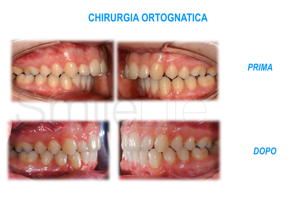 Chirurgia Ortognatica Dott.ssa Camilla Molinari