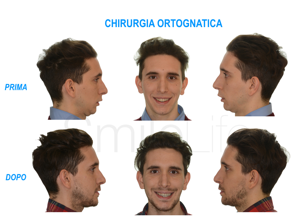 Chirurgia Ortognatica Dott.ssa Camilla Molinari